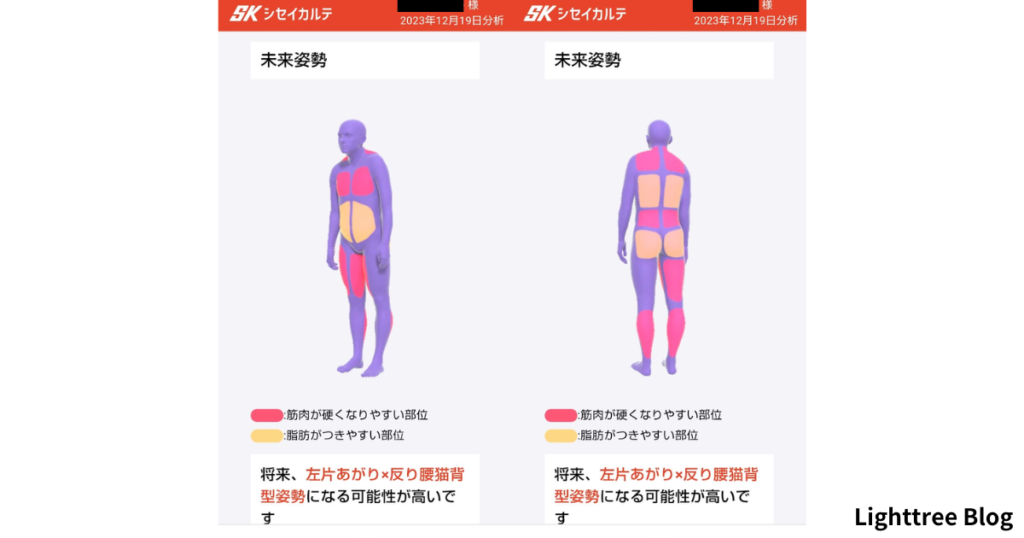 シセイカルテ測定結果の未来姿勢